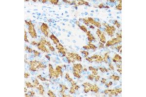 Immunohistochemistry of paraffin-embedded mouse pancreas using CTRL Rabbit mAb (ABIN7266395) at dilution of 1:100 (40x lens). (Chymotrypsin anticorps)