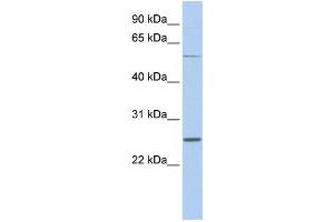 Western Blotting (WB) image for anti-Sodium Channel, Voltage-Gated, Type I, beta (SCN1B) antibody (ABIN2458126)