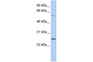 Western Blotting (WB) image for anti-Sodium Channel, Voltage-Gated, Type I, beta (SCN1B) antibody (ABIN2458126) (SCN1B anticorps)