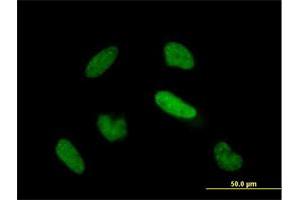 Immunofluorescence of purified MaxPab antibody to TIAL1 on HeLa cell.
