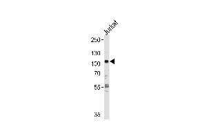 HK2 Antibody  f western blot analysis in Jurkat cell line lysates (35 μg/lane). (Hexokinase 2 anticorps  (AA 453-483))