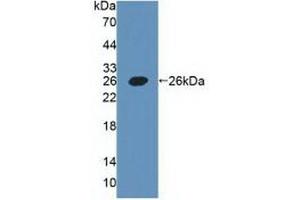 Detection of Recombinant PDPN, Human using Polyclonal Antibody to Podoplanin (PDPN) (Podoplanin anticorps  (AA 23-143))