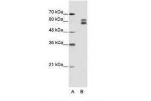Image no. 1 for anti-Mismatch Repair Protein 2 (MSH2) (AA 151-200) antibody (ABIN203217) (MSH2 anticorps  (AA 151-200))
