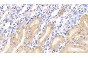 Detection of PIGR in Mouse Kidney Tissue using Polyclonal Antibody to Polymeric Immunoglobulin Receptor (PIGR)