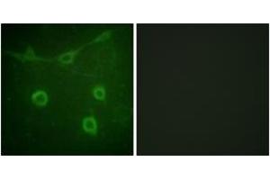 Immunofluorescence analysis of NIH-3T3 cells, using Trk A (Phospho-Tyr496) Antibody. (TRKA anticorps  (pTyr496))