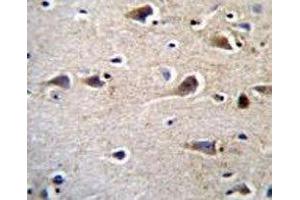 CRFR2D antibody immunohistochemistry analysis in formalin fixed and paraffin embedded human brain tissue. (CRFR2D anticorps)