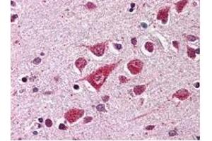 Anti-PPCA Antibody - Immunohistochemistry  Anti-PPCA antibody was diluted 1:500 to detect PPCA in human brain cortex tissue.