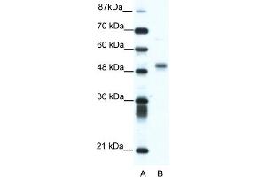 WB Suggested Anti-FLI1 Antibody Titration:  1. (FLI1 anticorps  (N-Term))