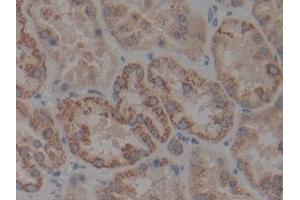 Detection of IkBb in Human Kidney Tissue using Polyclonal Antibody to Inhibitory Subunit Of NF Kappa B Beta (IkBb)