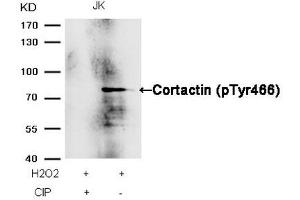 Western blot analysis of extracts from JK cells, treated with H2O2 or calf intestinal phosphatase (CIP), using Cortactin (Phospho-Tyr466) Antibody. (Cortactin anticorps  (pTyr466))