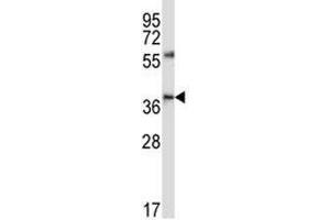 CD33 antibody western blot analysis in NCI-H460 lysate (CD33 anticorps  (AA 88-117))