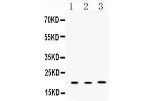 Western blot analysis of Anterior Gradient 2 expression in rat lung extract ( Lane 1), mouse liver extract ( Lane 2) and MCF-7 whole cell lysates ( Lane 3). (AGR2 anticorps  (AA 21-175))