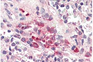 Human Spleen, Macrophages (formalin-fixed, paraffin-embedded) stained with TREM2 antibody ABIN337127 at 2. (TREM2 anticorps  (AA 199-212))