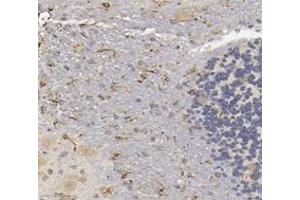 Immunohistochemistry analysis of paraffin-embedded mouse brain using,CHERP (ABIN7073277) at dilution of 1: 3600