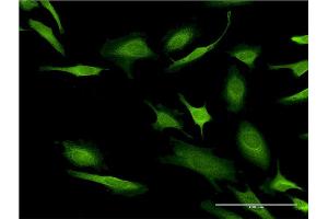 Immunofluorescence of monoclonal antibody to CASP10 on HeLa cell.
