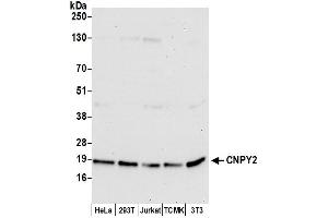 anti-Canopy 2 Homolog (CNPY2) (AA 100-150) antibody