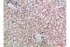 Immunohistochemical analysis of paraffin-embedded human-liver, antibody was diluted at 1:200 (MIA2 anticorps  (AA 361-410))