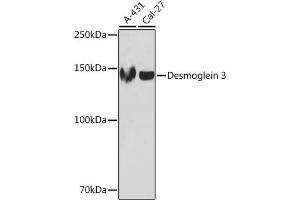 Western blot analysis of extracts of various cell lines, using Desmoglein 3 Rabbit mAb (ABIN7266741) at 1:1000 dilution. (Desmoglein 3 anticorps)