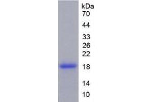 SDS-PAGE of Protein Standard from the Kit  (Highly purified E.