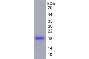 SDS-PAGE of Protein Standard from the Kit  (Highly purified E. (TNC Kit ELISA)