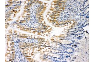 Anti-Caspase-3(P10) antibody,  IHC(P) IHC(P): Rat Intestine Tissue