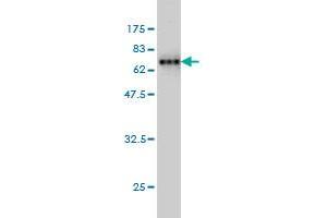 Western Blot detection against Immunogen (73.