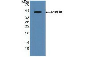 Western blot analysis of recombinant Human LXRa. (NR1H3 anticorps  (AA 95-434))