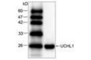 Image no. 1 for anti-Ubiquitin Carboxyl-terminal Esterase L1 (Ubiquitin Thiolesterase) (UCHL1) antibody (ABIN791511) (UCHL1 anticorps)
