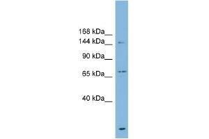 WB Suggested Anti-ABCB1 Antibody Titration:  0. (ABCB1 anticorps  (Middle Region))