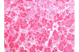 Human Adrenal: Formalin-Fixed, Paraffin-Embedded (FFPE) (G Protein-Coupled Receptor 133 anticorps  (C-Term))