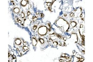 IHC analysis of CD146/MCAM using anti-CD146/MCAM antibody (ABIN7602098).