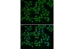 Immunofluorescence analysis of HeLa cells using BTK antibody (ABIN5970757). (BTK anticorps)
