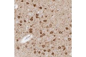 Immunohistochemical staining of human cerebral cortex with C9orf50 polyclonal antibody  shows strong cytoplasmic positivity in neurons. (C9ORF50 anticorps)
