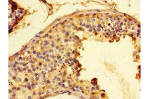 Immunohistochemistry of paraffin-embedded human testis tissue using ABIN7153916 at dilution of 1:100 (Glucose-6-Phosphate Dehydrogenase anticorps  (AA 80-185))