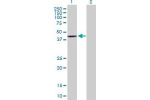 Western Blot analysis of SCCPDH expression in transfected 293T cell line by SCCPDH MaxPab polyclonal antibody.
