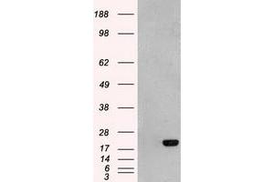 HEK293T cells were transfected with the pCMV6-ENTRY control (Left lane) or pCMV6-ENTRY AK1 (Right lane) cDNA for 48 hrs and lysed. (Adenylate Kinase 1 anticorps)