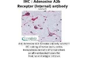 Image no. 1 for anti-Adenosine A2b Receptor (ADORA2B) (Internal Region) antibody (ABIN1731551) (Adenosine A2b Receptor anticorps  (Internal Region))