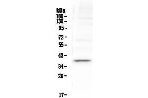 Western blot analysis of Tal1 using anti-Tal1 antibody . (TAL1 anticorps  (AA 174-259))