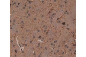 IHC-P analysis of Mouse Tissue, with DAB staining. (Fascin anticorps  (AA 27-273))