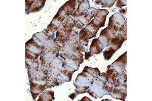 IHC analysis of RAB7/RAB7A using anti-RAB7/RAB7A antibody (ABIN7600597). (RAB7A anticorps  (AA 21-177))