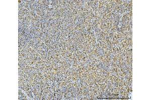 IHC analysis of CA1 using anti-CA1 antibody (ABIN3043766).