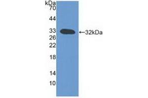 Detection of Recombinant LTb, Mouse using Polyclonal Antibody to Lymphotoxin Beta (LTb) (LTB anticorps  (AA 58-304))