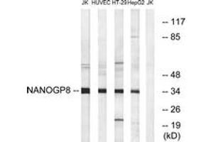 Western blot analysis of extracts from HuvEc/HT-29/HepG2/Jurkat cells, using NANOGP8 Antibody. (NANOGP8 anticorps  (AA 51-100))