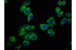 Immunofluorescence staining of A549 cells with ABIN7153289 at 1:100, counter-stained with DAPI.