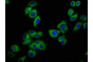 Immunofluorescence staining of A549 cells with ABIN7153289 at 1:100, counter-stained with DAPI. (KCNJ5 anticorps  (AA 348-419))