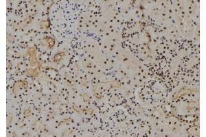 ABIN6273801 at 1/100 staining Rat kidney tissue by IHC-P. (NUAK2 anticorps  (Internal Region))