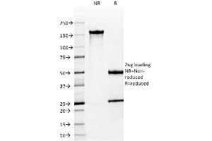 SDS-PAGE Analysis Purified MUC-1 / CA15-3 / EMA Mouse Monoclonal Antibody (MUC1/955).