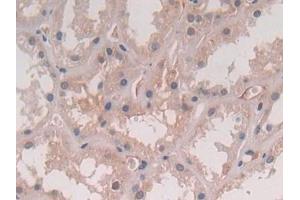 IHC-P analysis of Human Kidney Tissue, with DAB staining. (IL-5 anticorps  (AA 20-134))