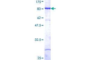 Image no. 1 for Mitogen-Activated Protein Kinase Kinase Kinase 8 (MAP3K8) (AA 1-467) protein (GST tag) (ABIN1310237)