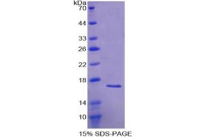 SDS-PAGE analysis of Human ACVR1 Protein. (ACVR1 Protéine)